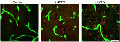 Neural Damage in Experimental Trypanosoma brucei gambiense Infection: Hypothalamic Peptidergic Sleep and Wake-Regulatory Neurons